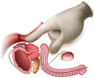 Prostate massage