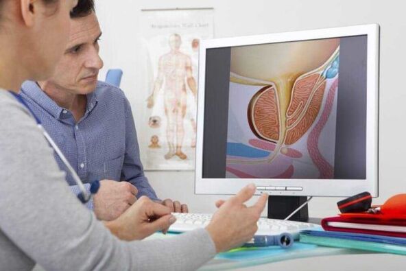 Doctor advising patient about prostatitis
