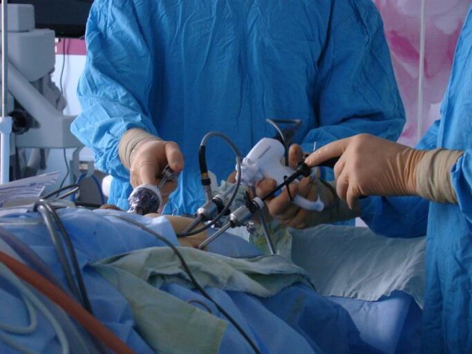 Prostatitis surgery
