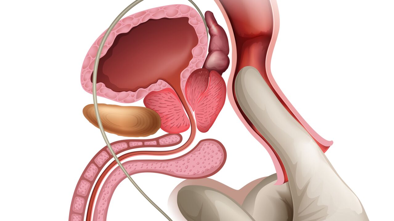 Prostate massage is an effective treatment for congestive prostatitis