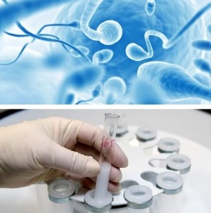 Semen