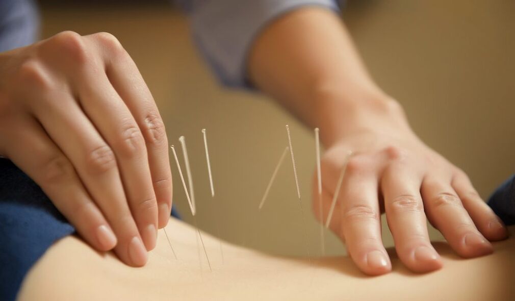 Acupuncture is a popular treatment for chronic prostatitis
